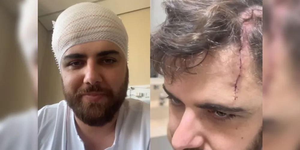 Zé Neto cantor sertanejo sofre acidente